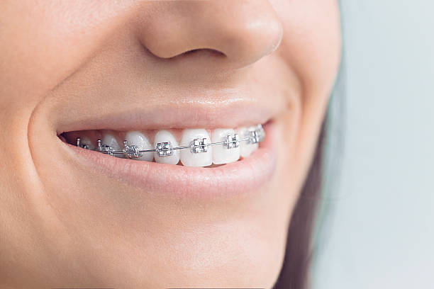 Best Tooth Extraction  in Springhill, LA